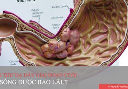 Người bị ung thư dạ dày giai đoạn cuối sống được bao lâu?