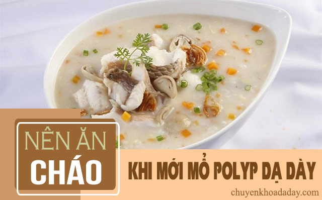 lưu ý khi mổ nội soi polyp dạ dày