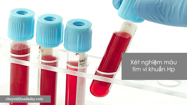 Xét nghiệm máu để chẩn đoán vi khuẩn Hp