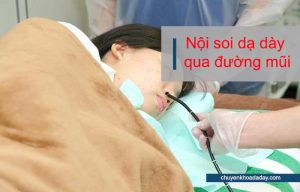 Nội soi dạ dày thông qua đường mũi