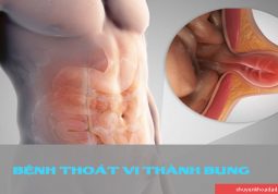 Bệnh thoát vị thành bụng