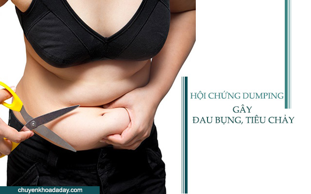 Hội chứng Dumping là một trong những nguyên nhân gây đau bụng, tiêu chảy, buồn nôn