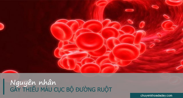 Xuất hiện các cục máu đông là một trong những nguyên nhân gây bệnh thiếu máu cục bộ đường ruột