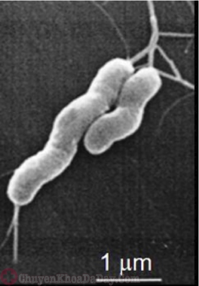 Tuổi thọ của vi khuẩn Hp khi ra môi trường bên ngoài dạ dày-2