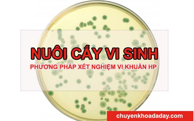 Xét nghiệm vi khuẩn Hp bằng nuôi cấy vi sinh