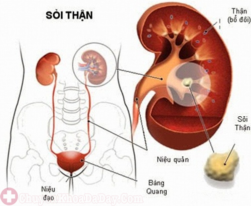 Đau âm ỉ bụng dưới bên trái ở nam giới