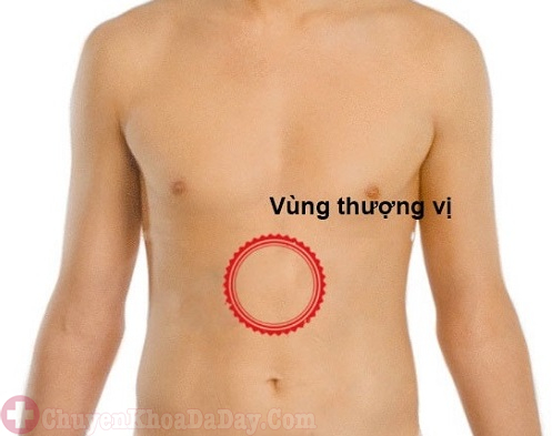 Thượng vị dạ dày nằm ở đâu?