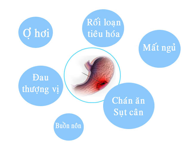 Triệu chứng viêm loét dạ dày