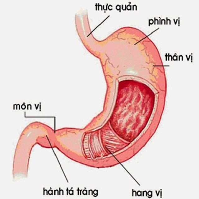 Viêm hang vị dạ dày