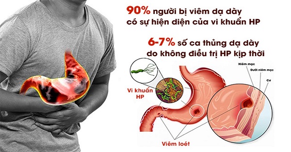 Mối nguy hại của khuẩn HP dạ dày